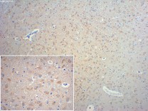 NEFH Recombinant Rabbit Monoclonal Antibody