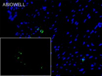 JAK1 Recombinant Rabbit Monoclonal  Antibody