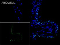 STAT3(Phospho Ser727) Recombinant Rabbit Monoclonal Antibody