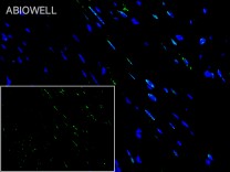 STAT3(Phospho Ser727) Recombinant Rabbit Monoclonal Antibody