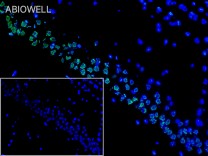 STAT3(Phospho Ser727) Recombinant Rabbit Monoclonal Antibody