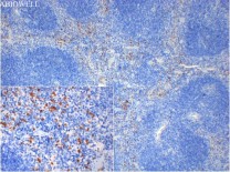 Annexin I Rabbit Monoclonal Antibody