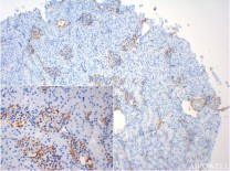 Annexin I Rabbit Monoclonal Antibody