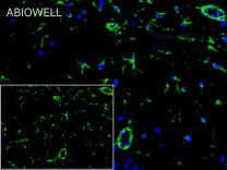 ALDH1L1 Recombinant Rabbit Monoclonal Antibody