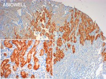 LATS1/2(Phospho Ser909) Rabbit Polyclonal Antibody