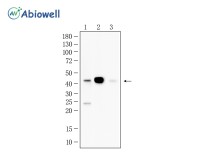 NDRG1 Recombinant Rabbit Monoclonal Antibody