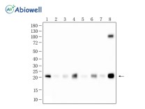 TMP21 Recombinant Rabbit Monoclonal Antibody