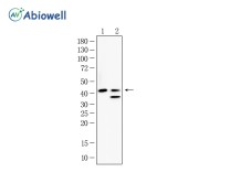 ATF4 Recombinant Rabbit Monoclonal Antibody