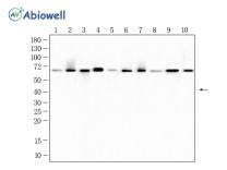 Lamin B1 Recombinant Rabbit Monoclonal Antibody