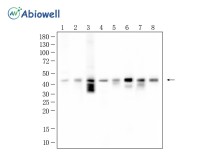 CCR7 Recombinant Rabbit Monoclonal Antibody