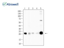 HBEGF Recombinant Rabbit Monoclonal Antibody