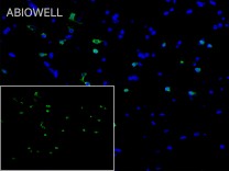 CD86 Recombinant Rabbit Monoclonal Antibody