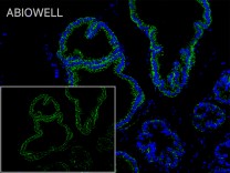 Claudin 1 Rabbit Polyclonal Antibody