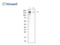 Collagen III Recombinant Rabbit Monoclonal Antibody