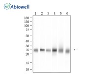 PARK7/DJ1 Recombinant Rabbit Monoclonal Antibody