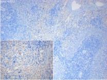 CD40L Recombinant Rabbit Monoclonal Antibody