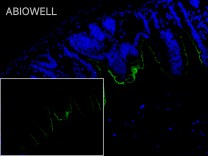 ACE2 Rabbit Polyclonal Antibody