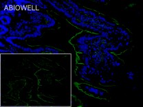 ACE2 Rabbit Polyclonal Antibody