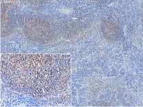 LY75 Recombinant Rabbit Monoclonal Antibody