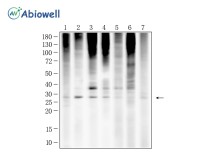 Ubiquitin(linkage-specific K63) Recombinant Rabbit Monoclonal Antibody