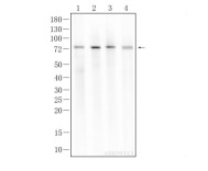 NF2 Recombinant Rabbit Monoclonal Antibody