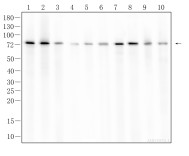 NF2 Recombinant Rabbit Monoclonal Antibody