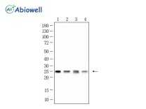 SOD2 Recombinant Rabbit Monoclonal  Antibody