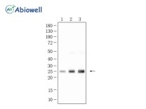 SOD2 Recombinant Rabbit Monoclonal  Antibody