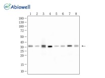 NQO1 Recombinant Rabbit Monoclonal Antibody