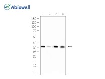 NQO1 Recombinant Rabbit Monoclonal Antibody