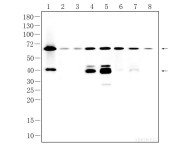 MST2 Recombinant Rabbit Monoclonal Antibody