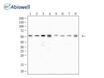 Gamma Tubulin Recombinant Rabbit Monoclonal Antibody