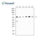 Gamma Tubulin Recombinant Rabbit Monoclonal Antibody