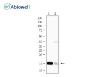 Histone H3(Acetyl K14) Recombinant Rabbit Monoclonal Antibody