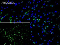 NEFH Recombinant Rabbit Monoclonal Antibody