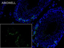 Bax Recombinant Rabbit Monoclonal Antibody