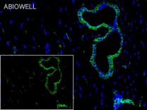 ULK1(Phospho Ser555)Rabbit Polyclonal Antibody