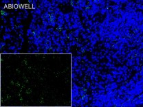 ULK1(Phospho Ser555)Rabbit Polyclonal Antibody