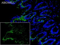 ULK1(Phospho Ser555)Rabbit Polyclonal Antibody