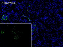 Claudin 5 Rabbit Polyclonal Antibody