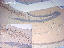 Ubiquitin(linkage-specific K63) Recombinant Rabbit Monoclonal Antibody