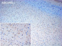 Ubiquitin(linkage-specific K63) Recombinant Rabbit Monoclonal Antibody