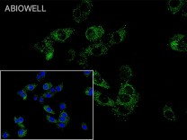 MYH1 Recombinant Rabbit Monoclonal Antibody