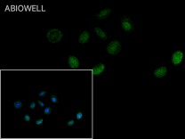 DNMT3A Recombinant Rabbit Monoclonal Antibody