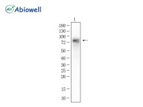 Tyrosinase Recombinant Rabbit Monoclonal Antibody