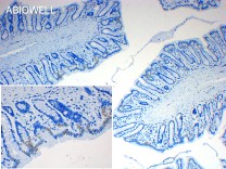 SP1 Recombinant Rabbit Monoclonal Antibody