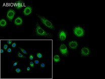 Calreticulin Recombinant Rabbit Monoclonal  Antibody