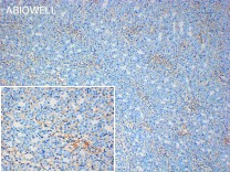 Collagen IV Rabbit Polyclonal Antibody