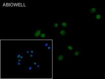 VDR Rabbit Polyclonal Antibody