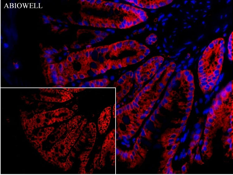 Fig: Fluorescence immunohistochemical analysis of mouse-colon tissue (Formalin / PFA-fixed paraffin-embedded sections) with mouse anti-SQSTM1 antibody (AWA00001) at 1/100 dilution.

The immunostaining was performed with the TSA Immuno-staining Kit (ABIOWELL, AWI0689). The section was pre-treated using heat mediated antigen retrieval with EDTA buffer (pH 9.0) for 20 minutes. The tissues were blocked in 5% BSA for 60 minutes at 37℃, washed with ddH2O and PBS, and then probed with the primary antibody (AWA00001) at 1/100 dilution for 1 hour at room temperature. The detection was performed using an HRP conjugated compact polymer system followed by a separate fluorescent tyramide signal amplification system (red). DAPI (blue, AWC0291) was used as a nuclear counter stain. Image acquisition was performed with  Slide Scanner.